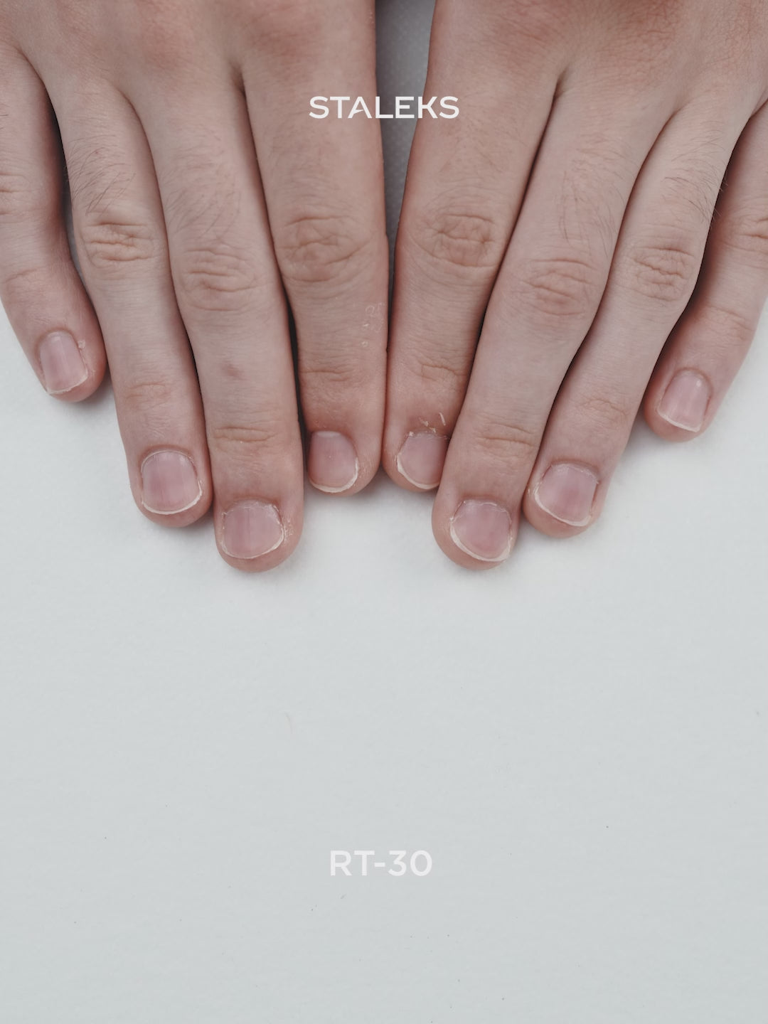 Załaduj wideo: STALEKS Remover do skórek, 30 ml